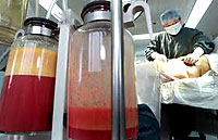 Weighing the Risks of Liposuction Against the Benefits Weighing the Risks of Liposuction Against the Benefits